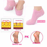 Picture of Ultra Soft Moisturizing Socks With Spa Gel Vitamin E And Oil Infuse For Repair Dry Cracked Skins (Assorted Color)